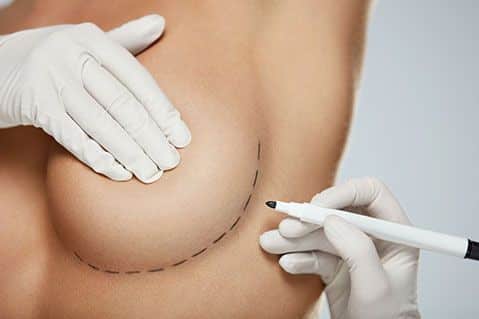 Tout savoir sur la réduction mammaire avec le Dr Runge - Paris 7 et Beauvais